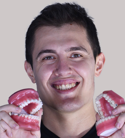 Furkan Açıkgözoğlu